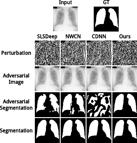 Figure 1 for Non-Local Context Encoder: Robust Biomedical Image Segmentation against Adversarial Attacks