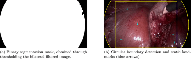 Figure 3 for Deep Homography Estimation in Dynamic Surgical Scenes for Laparoscopic Camera Motion Extraction