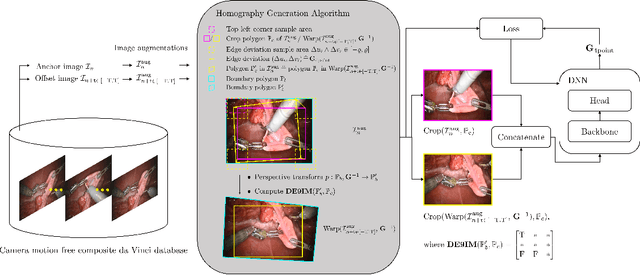 Figure 4 for Deep Homography Estimation in Dynamic Surgical Scenes for Laparoscopic Camera Motion Extraction