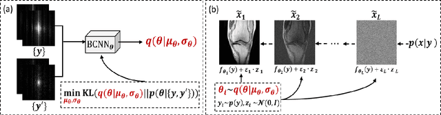Figure 1 for Self-Score: Self-Supervised Learning on Score-Based Models for MRI Reconstruction