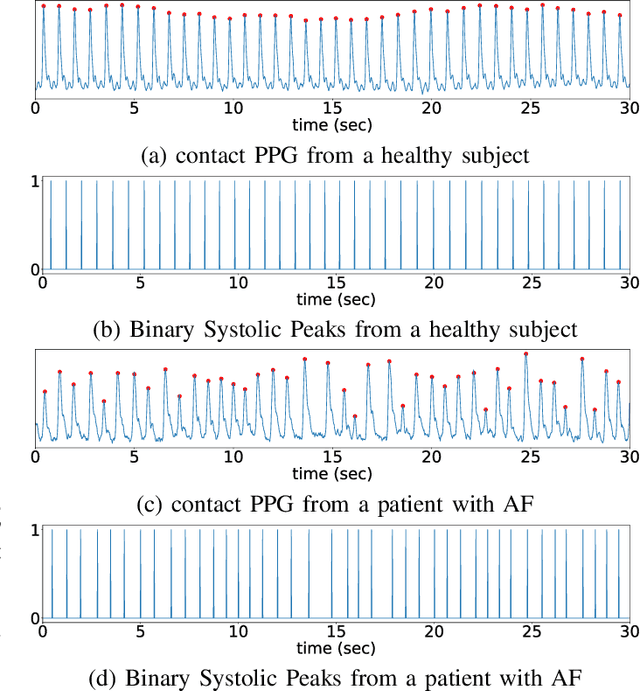 Figure 3 for Non-contact Atrial Fibrillation Detection from Face Videos by Learning Systolic Peaks