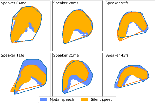 Figure 4 for Silent versus modal multi-speaker speech recognition from ultrasound and video