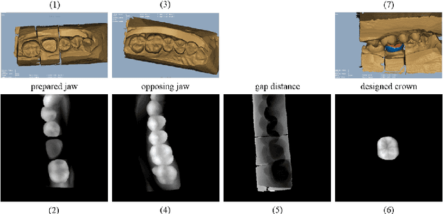 Figure 1 for Learning Beyond Human Expertise with Generative Models for Dental Restorations