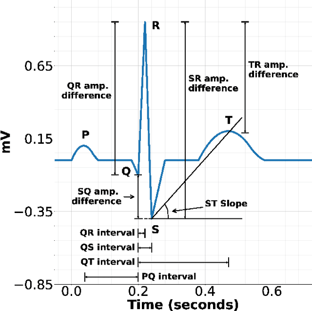 Figure 3 for Piece-wise Matching Layer in Representation Learning for ECG Classification