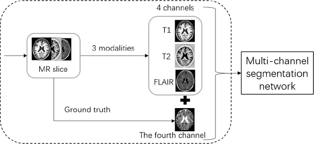 Figure 1 for A Multi-channel Network with Image Retrieval for Accurate Brain Tissue Segmentation
