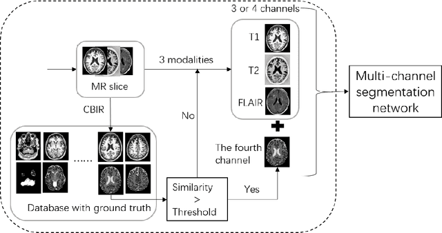 Figure 3 for A Multi-channel Network with Image Retrieval for Accurate Brain Tissue Segmentation