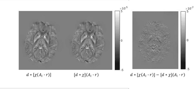 Figure 1 for Motion Artifact Reduction in Quantitative Susceptibility Mapping using Deep Neural Network