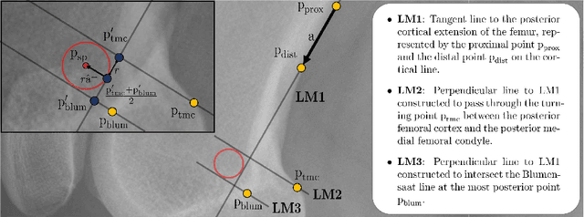 Figure 1 for Multi-task Localization and Segmentation for X-ray Guided Planning in Knee Surgery