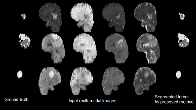 Figure 4 for Conditional Adversarial Network for Semantic Segmentation of Brain Tumor