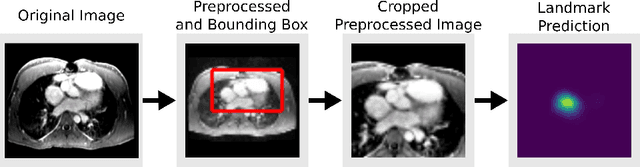 Figure 3 for Computationally efficient cardiac views projection using 3D Convolutional Neural Networks