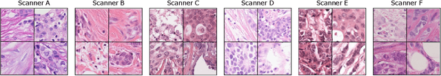 Figure 3 for Mitosis domain generalization in histopathology images -- The MIDOG challenge