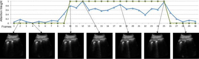 Figure 1 for Automatic Detection of B-lines in Lung Ultrasound Videos From Severe Dengue Patients