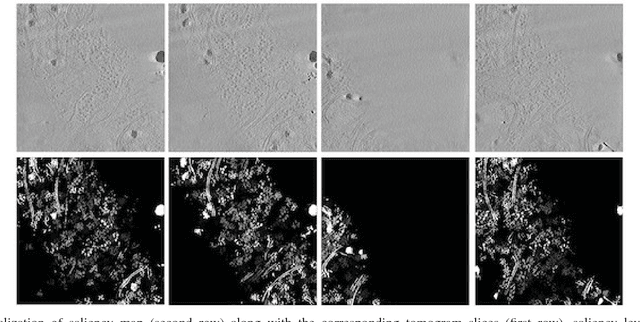 Figure 1 for Feature Decomposition Based Saliency Detection in Electron Cryo-Tomograms
