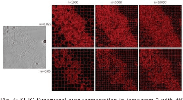 Figure 4 for Feature Decomposition Based Saliency Detection in Electron Cryo-Tomograms