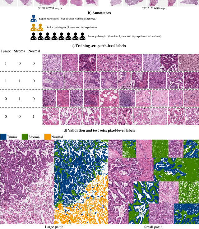 Figure 2 for WSSS4LUAD: Grand Challenge on Weakly-supervised Tissue Semantic Segmentation for Lung Adenocarcinoma