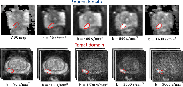 Figure 1 for Unsupervised Domain Adaptation with Semantic Consistency across Heterogeneous Modalities for MRI Prostate Lesion Segmentation