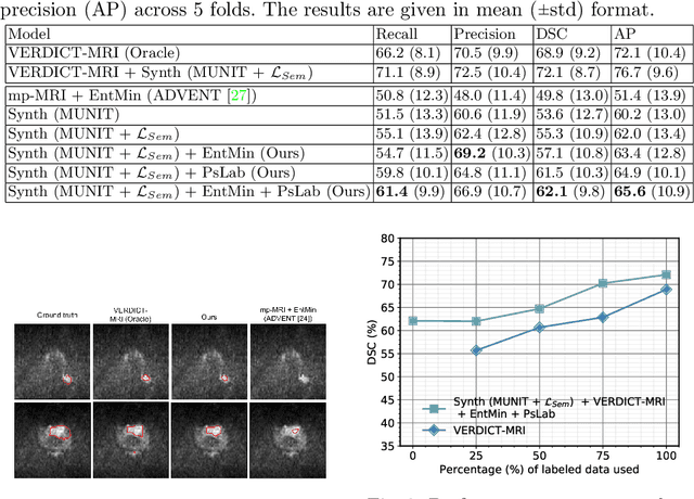 Figure 2 for Unsupervised Domain Adaptation with Semantic Consistency across Heterogeneous Modalities for MRI Prostate Lesion Segmentation