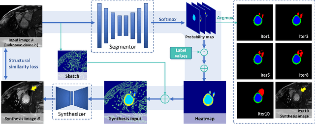 Figure 3 for Online Reflective Learning for Robust Medical Image Segmentation