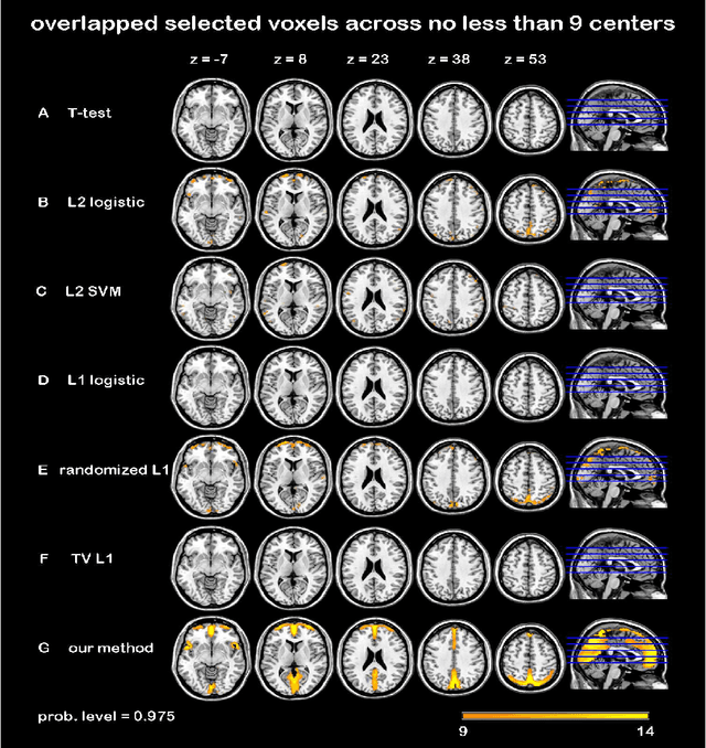 Figure 2 for Randomized Structural Sparsity based Support Identification with Applications to Locating Activated or Discriminative Brain Areas: A Multi-center Reproducibility Study