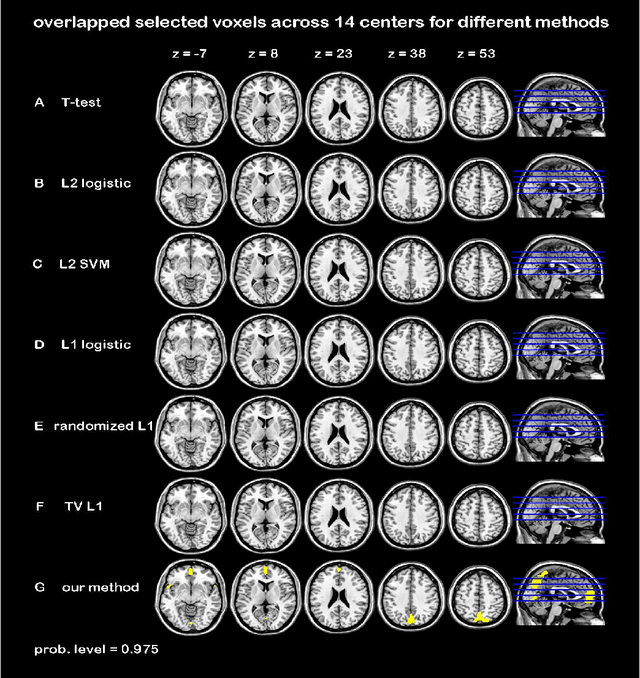 Figure 4 for Randomized Structural Sparsity based Support Identification with Applications to Locating Activated or Discriminative Brain Areas: A Multi-center Reproducibility Study