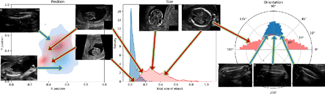 Figure 1 for BiometryNet: Landmark-based Fetal Biometry Estimation from Standard Ultrasound Planes