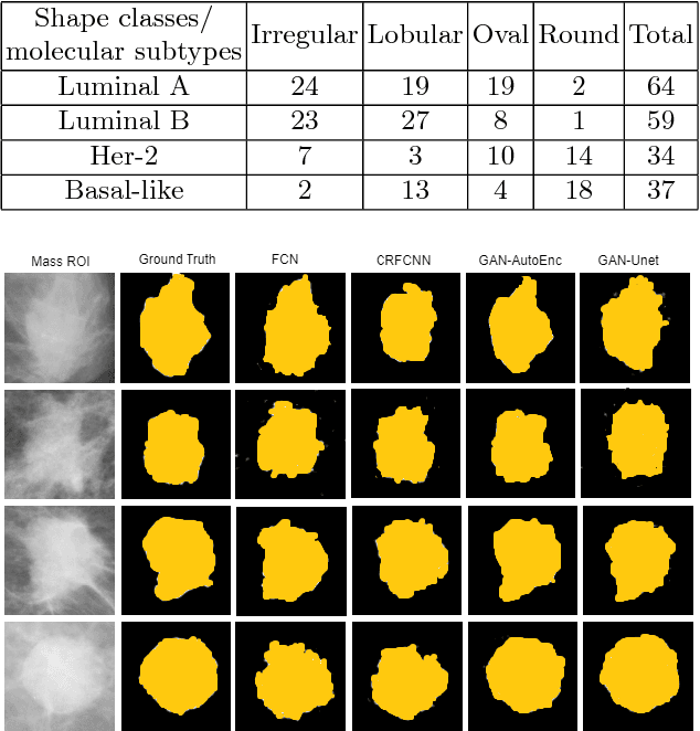 Figure 3 for Conditional Generative Adversarial and Convolutional Networks for X-ray Breast Mass Segmentation and Shape Classification