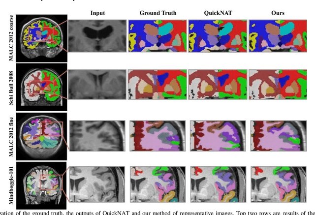 Figure 4 for ACEnet: Anatomical Context-Encoding Network for Neuroanatomy Segmentation