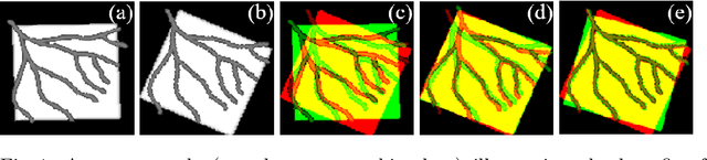 Figure 1 for Image-and-Spatial Transformer Networks for Structure-Guided Image Registration