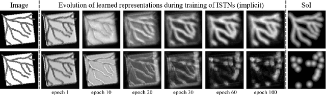 Figure 4 for Image-and-Spatial Transformer Networks for Structure-Guided Image Registration