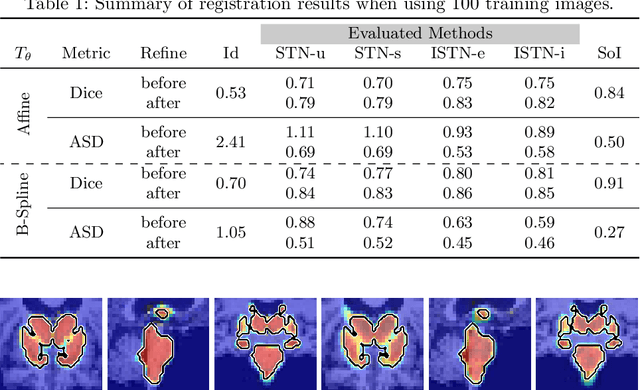Figure 2 for Image-and-Spatial Transformer Networks for Structure-Guided Image Registration