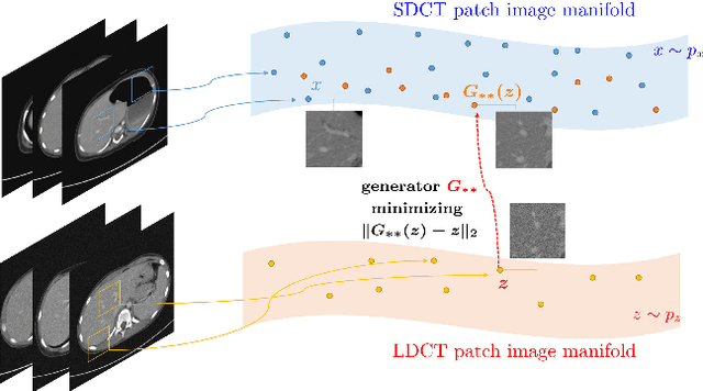 Figure 3 for Unpaired image denoising using a generative adversarial network in X-ray CT