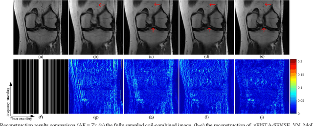 Figure 2 for pISTA-SENSE-ResNet for Parallel MRI Reconstruction