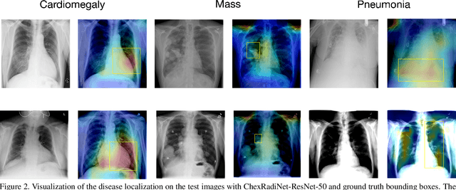 Figure 3 for Using Radiomics as Prior Knowledge for Abnormality Classification and Localization in Chest X-rays
