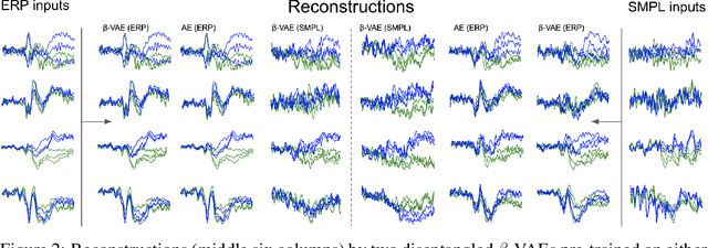 Figure 3 for Representation learning for improved interpretability and classification accuracy of clinical factors from EEG