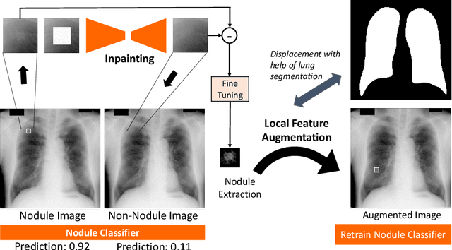 Figure 1 for Extracting and Leveraging Nodule Features with Lung Inpainting for Local Feature Augmentation
