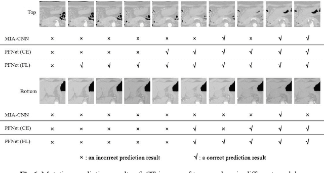 Figure 4 for Pyramid Focusing Network for mutation prediction and classification in CT images