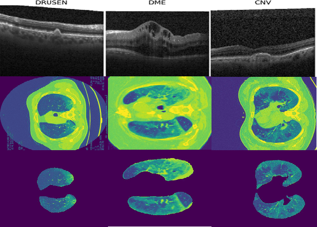Figure 3 for QU-net++: Image Quality Detection Framework for Segmentation of 3D Medical Image Stacks