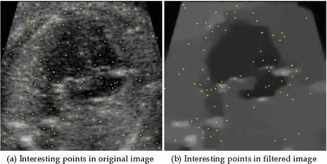 Figure 3 for 4D Cardiac Ultrasound Standard Plane Location by Spatial-Temporal Correlation