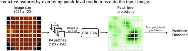 Figure 1 for Semi-Supervised Deep Learning for Abnormality Classification in Retinal Images
