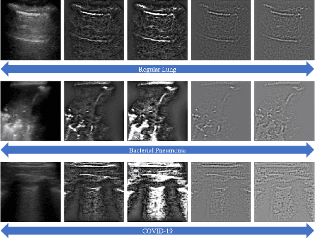 Figure 1 for Multi-Feature Multi-Scale CNN-Derived COVID-19 Classification from Lung Ultrasound Data