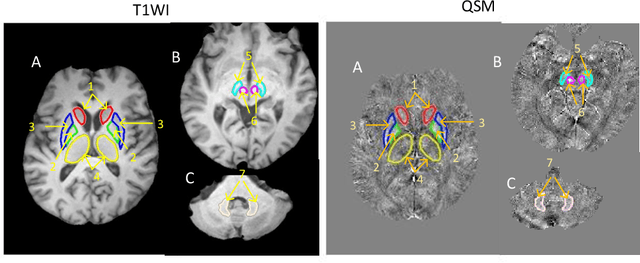 Figure 1 for Automated Segmentation of Brain Gray Matter Nuclei on Quantitative Susceptibility Mapping Using Deep Convolutional Neural Network