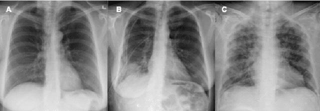 Figure 1 for COVIDx CXR-3: A Large-Scale, Open-Source Benchmark Dataset of Chest X-ray Images for Computer-Aided COVID-19 Diagnostics