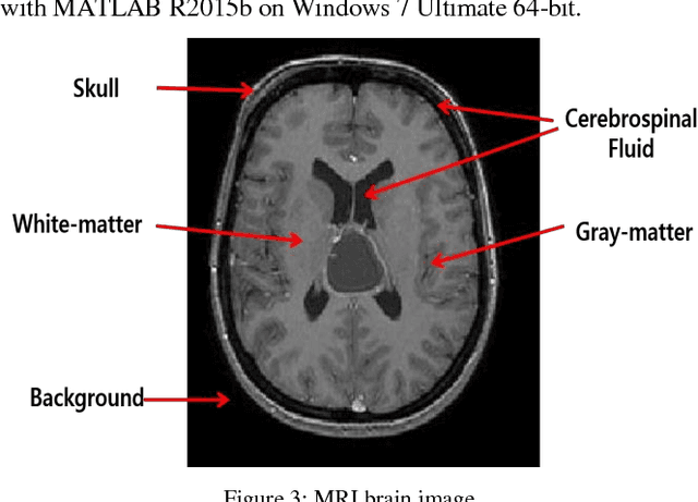 Figure 3 for Brain MRI Segmentation using Rule-Based Hybrid Approach