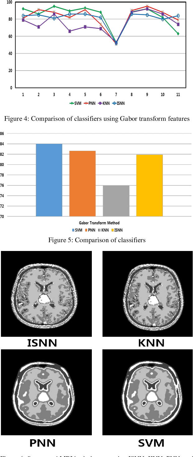 Figure 4 for Brain MRI Segmentation using Rule-Based Hybrid Approach