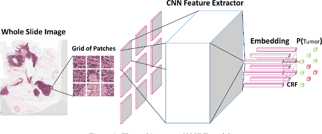 Figure 1 for Cancer Metastasis Detection With Neural Conditional Random Field