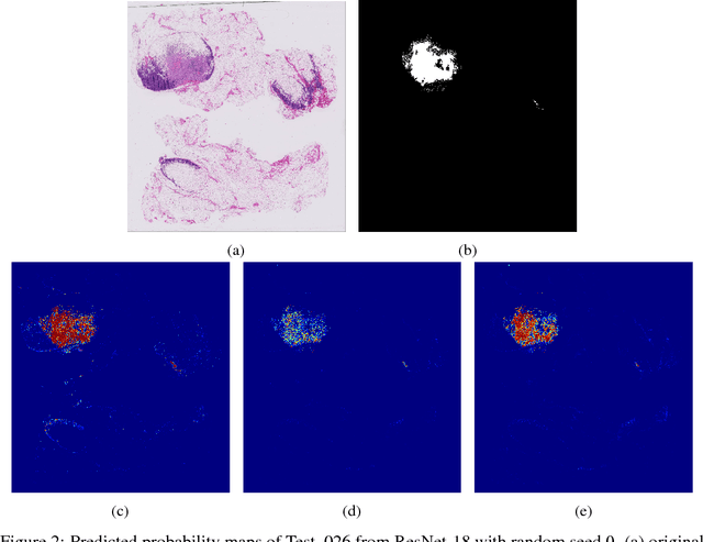 Figure 2 for Cancer Metastasis Detection With Neural Conditional Random Field
