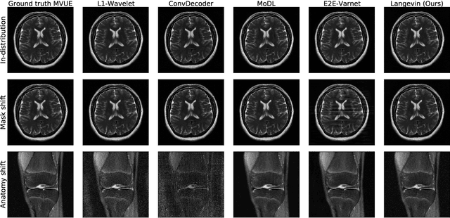 Figure 1 for Robust Compressed Sensing MRI with Deep Generative Priors