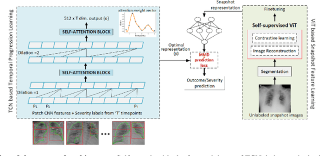 Figure 3 for Temporal Context Matters: Enhancing Single Image Prediction with Disease Progression Representations
