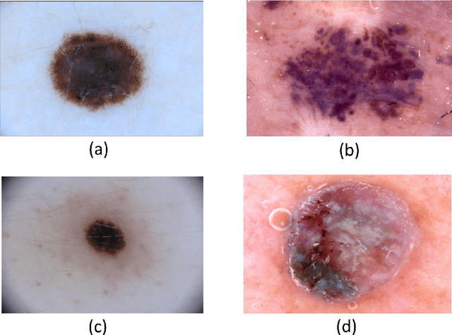 Figure 1 for CancerNet-SCa: Tailored Deep Neural Network Designs for Detection of Skin Cancer from Dermoscopy Images