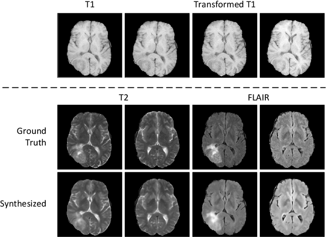 Figure 4 for Fast T2w/FLAIR MRI Acquisition by Optimal Sampling of Information Complementary to Pre-acquired T1w MRI